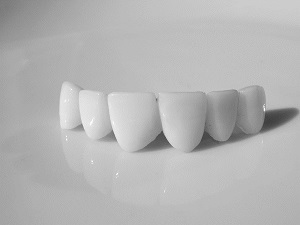 aurora dental bridges