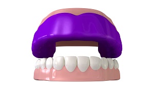 mouthguard aurora